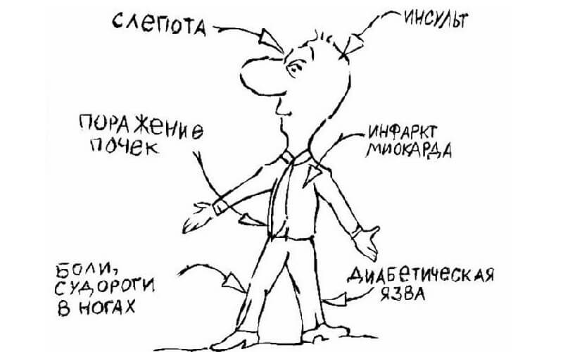 диабет
